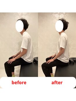 ナオル整体 福岡香椎院(NAORU整体)/30代男性施術事例【猫背】