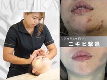 ミチカ(MICHIKA)の雰囲気（ニキビケアもMICHIKA美療サロンにお任せ！）