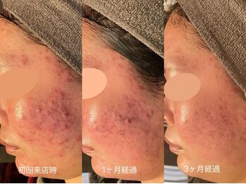 サロン デ ミロ(Salon de Miro)/BeforeAfter多数！ブログへGO♪