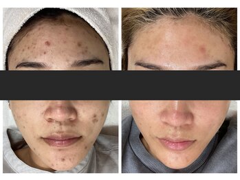 エアリアル 中津店/コンテストグランプリ受賞お写真