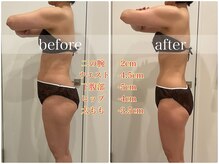 ビビ センター北店(Bibi)/ビフォーアフター