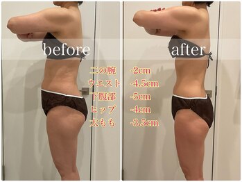 ビビ センター北店(Bibi)/ビフォーアフター