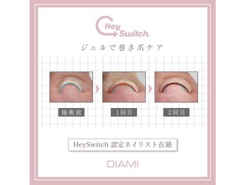 巻き爪改善＋ワンカラー