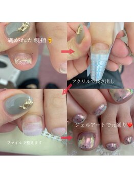ユーネイル(you NAIL)/割れたお爪の補強