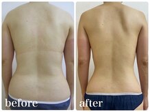 加圧ビューティーサロン スタイル エム(beauty salon style M)/40代/ピラティス×痩身120分