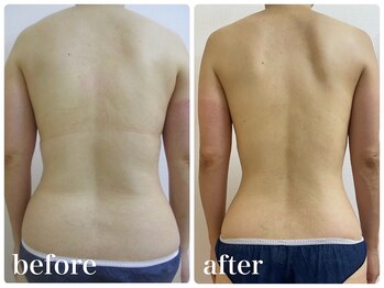 加圧ビューティーサロン スタイル エム(beauty salon style M)/40代/ピラティス×痩身120分