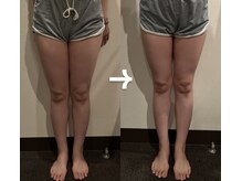 パーフェクトボディ(PERFECT BODY)/あなたも必ずマイナス3cm