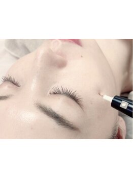 美白ケアをしたい