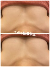 タイカ(Taika)/ハリ感ふわもちバストアップ