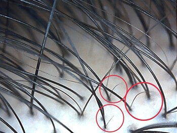 エルール トータルビューティ(Aileure total beauty)/新しくないところから　生える