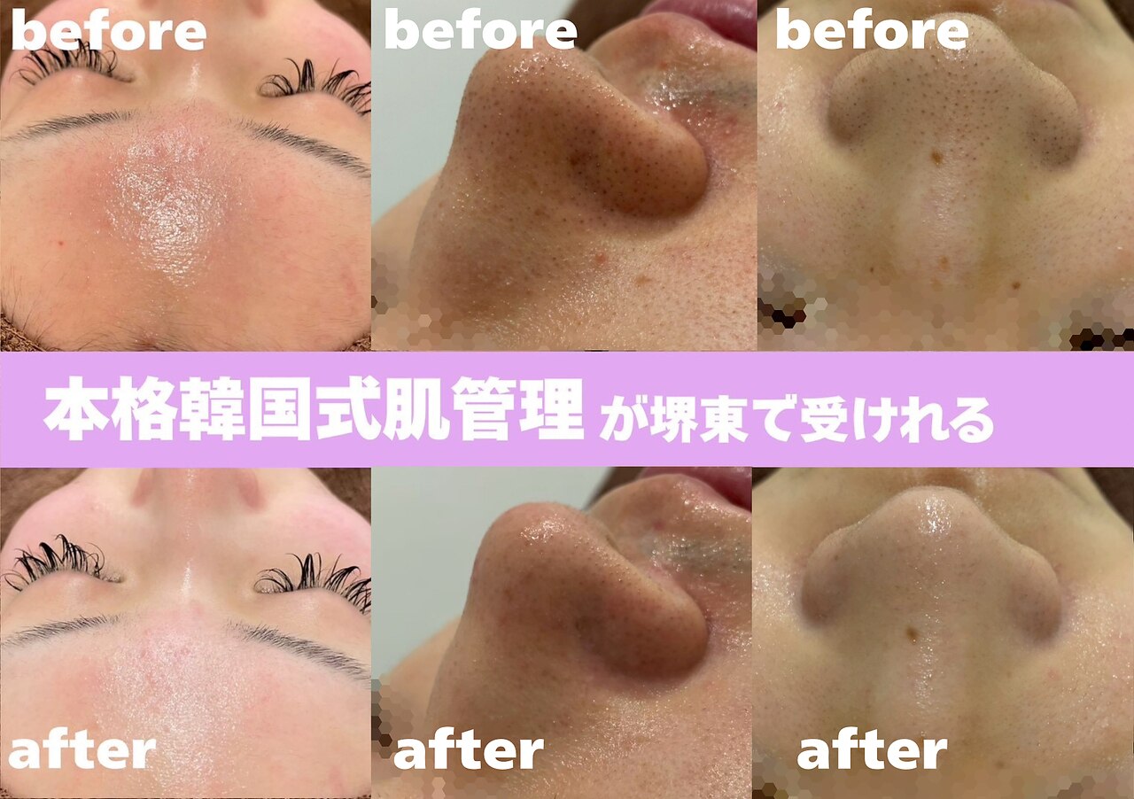 トリュフォワール　ホワイトトリュフ　フェイシャルピーリング Rare Earth Deep Pore Daily Cleanser - Kiehl's Since 1851 | Sephora