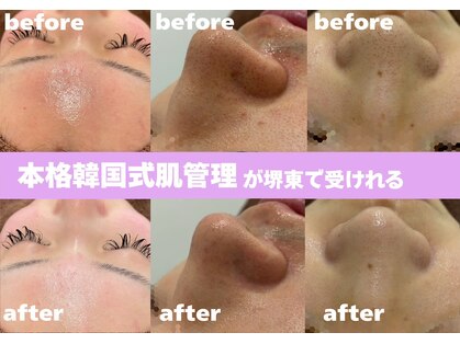 ホワイトラボ 堺東(White labo)の写真