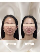 トロワ(TROIS)/看護師が黄金比を計算して注入