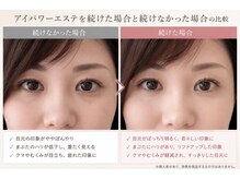 ヴィライズ 船橋(VIRISE)の雰囲気（目元悩みを解決！千葉県初【アイパワーエステ】/東船橋駅/船橋）