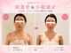 ビオール 池袋店(beall)の写真/顔の変化が目で見てわかる◎【小顔矯正60分6900円】眠ってしまうほど優しい施術で理想の小顔を実現&持続
