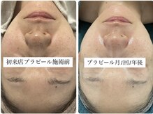 グラン ジュテの雰囲気（ララピール越えプラピールやエクソソームで爆速艶肌美肌に。）
