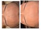 フレイヤ 門前仲町店(FREYA)の写真/【美白×エイジングケア】ララピール×悩み別８種の美容液で透明感とハリ艶のある肌へ◎