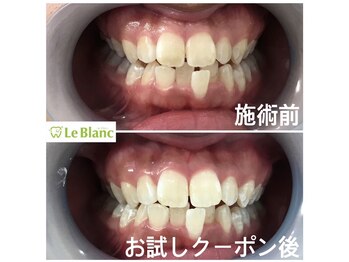 ルブラン 奈良店(Le Blanc)/全身の健康はお口元から!!