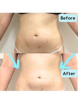 リオンズ 千葉アリオ柏店/理想のお体に☆【痩身】