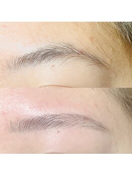 ソナ(sona)/アイブロウWAX脱毛