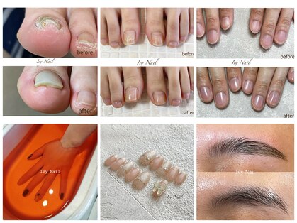 アイビーネイル(Ivy Nail)の写真