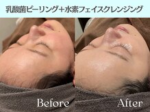 ロイボーテ(ROI Beaute)/つるんと輝くツヤ肌へ