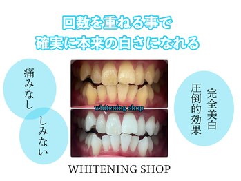 ホワイトニングショップ 刈谷店