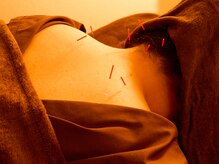 プライベート鍼灸サロン 十三 【肩こり/腰痛/マッサージ】