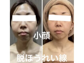 エステティック レイビス 川崎店(RAYVIS)/