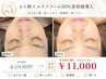 人気No2【たるみ・ほうれい線】オーダーメイドフェイシャル80分/AI肌測定付
