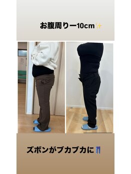 ヴェリテ(Verite)/before after 40代