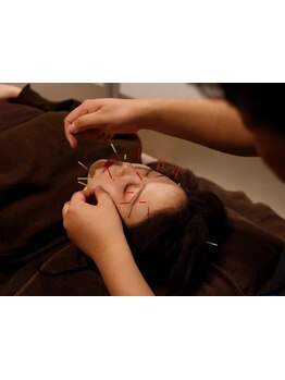 鍼灸施術を受けたい