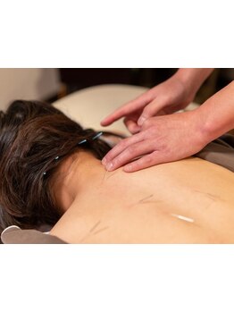 首・肩のつらさを改善したい