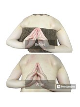 スカイ(sky)/肩こり・巻き肩・猫背改善