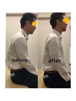 クマモト整骨院/ビフォーアフター