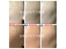 ワンサロン(One Salon)の雰囲気（光フォト3900円でクリアな美肌に！セルフで気になる所を念入りに）