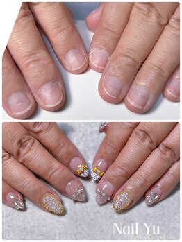 ネイルユー(Nail Yu)/長さ出し10本&定額コース