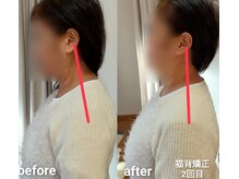 エム(M)/整体　姿勢改善