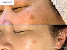 ビューティー ブロッサム(Beauty Blossom)/