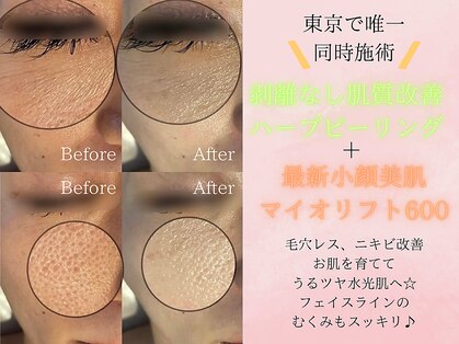 ミスワイ 麻布十番店(Ms.Y)の写真