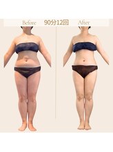 マクイエステティック 表参道店/50代ビフォーアフター