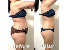 プライベート女性専用サロンだからこそ、安心してご相談ください