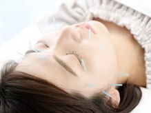 シミやしわ、ほうれい線を徹底ケア◎自慢の美容鍼をどうぞ♪