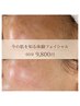 【迷う方はこちら】今の肌を知る体験フェイシャル
