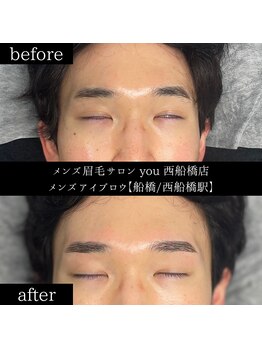 ユー 西船橋店(you)/ビフォーアフター写真