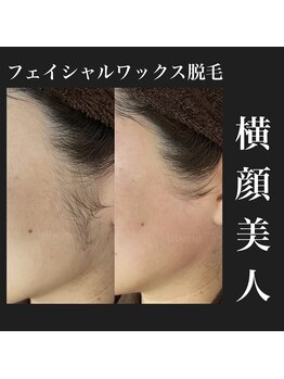 リベルテ 岡山(liberte)/フェイシャルワックス脱毛