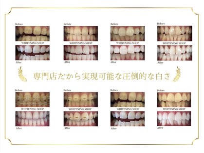 ホワイトニングショップ 熊谷店の写真