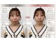 則武の整骨院の写真/【エラ張り・むくみ・左右差に】骨格から整える小顔矯正で理想のフェイスラインへ♪肩こり解消にも◎