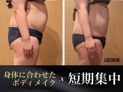 アクアリジェの写真