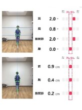 ティーシー(TC)/